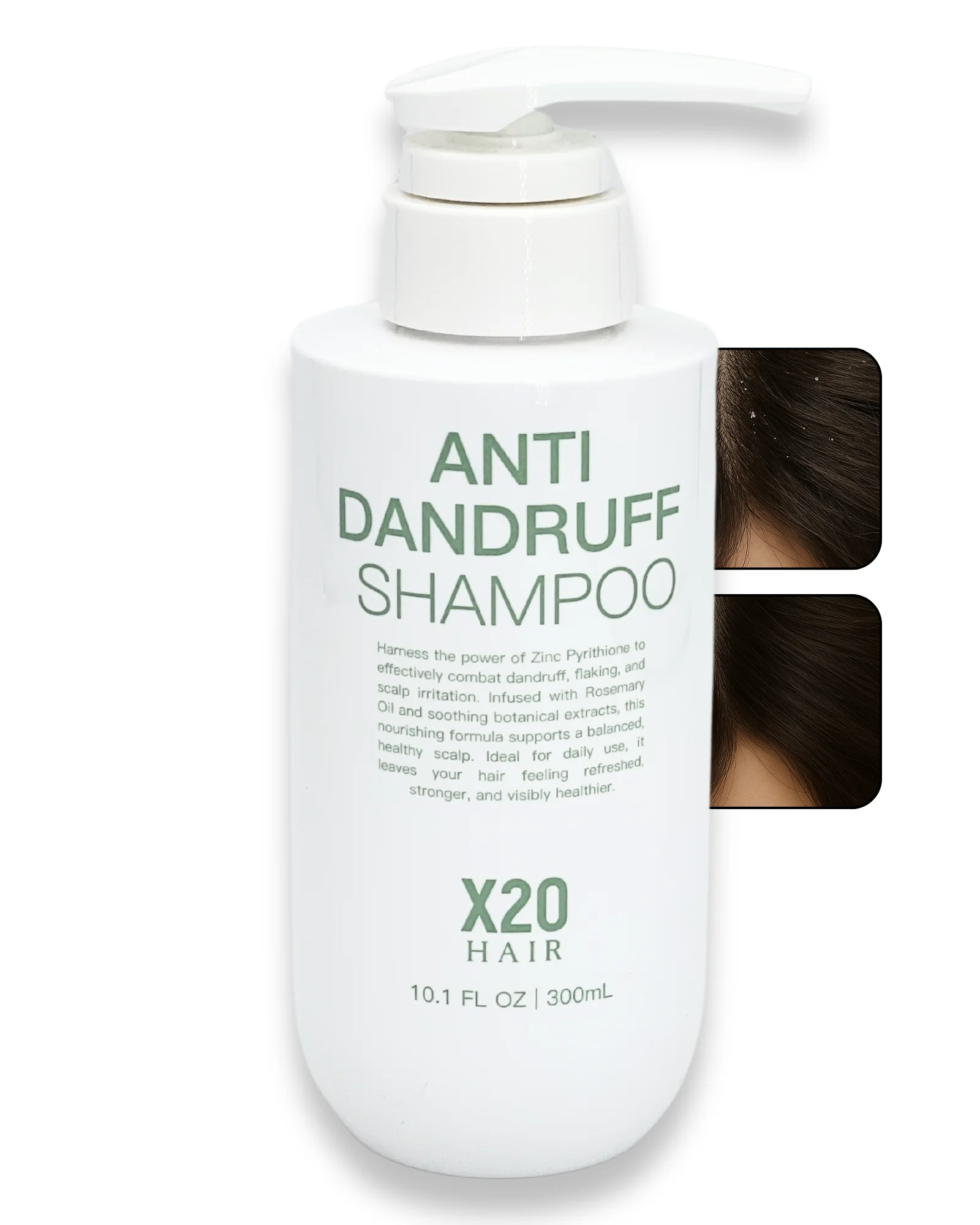 Flake Control Shampoo – X20HAIR – Effective Solutions for Dandruff