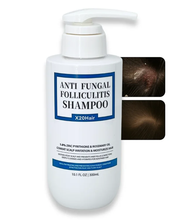 Scalp Comfort Shampoo